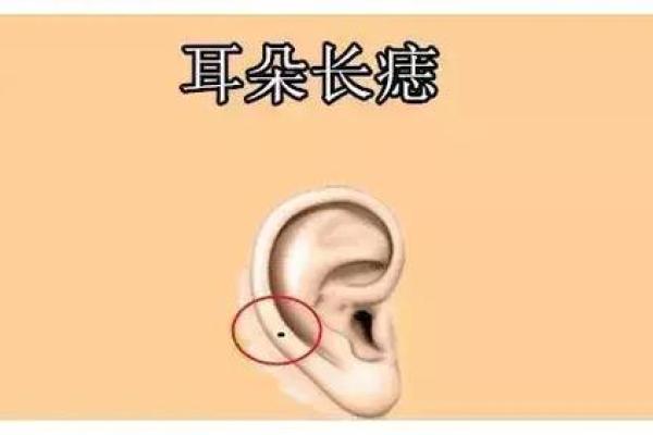 屁股左边胎记解析:你与命运的秘密联系 屁股左边胎记解析:你与命运的秘密联系