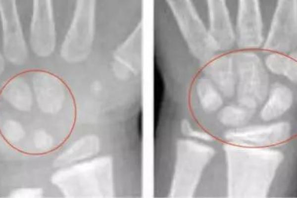 女的骨头硬的特征与命运探讨:揭秘背后的秘密与影响 女的骨头硬的特征与命运探讨:揭秘背后的秘密与影响