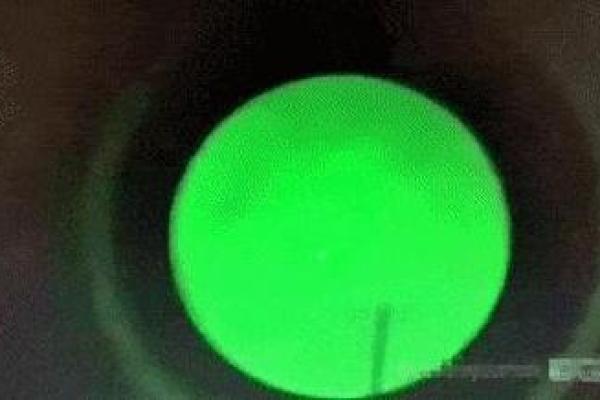 男人嘴下有黑斑的命理解析：影响运势与健康的神秘信号