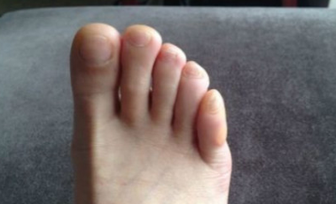 什么样的脚型会让你成为富贵命女?探寻脚型与命运的秘密! 什么样的脚型会让你成为富贵命女?探寻脚型与命运的秘密!