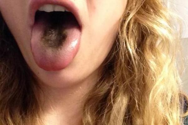 舌头太长的人命好。探秘舌缘与命运的奇妙关联！