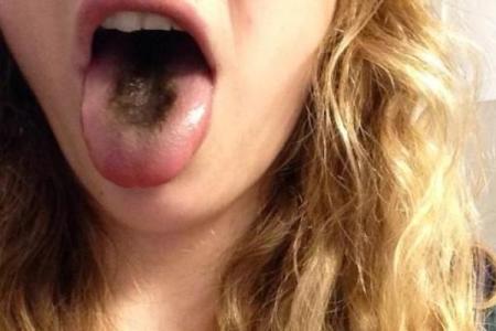 舌头太长的人命好。探秘舌缘与命运的奇妙关联！