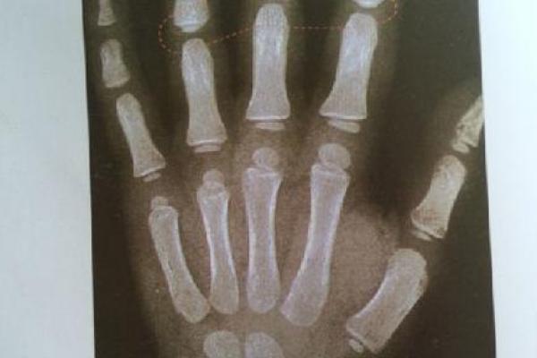 手比较嫩的男孩,命格与性格分析 手比较嫩的男孩,命格与性格分析