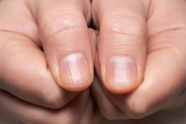 手上月牙凹陷揭示的命运之谜:你知道吗? 手上月牙凹陷揭示的命运之谜:你知道吗?