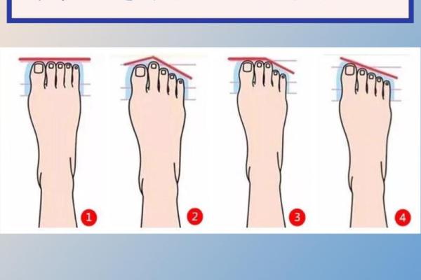 脚趾形状与命运:什么样的脚趾是富贵命的标志? 脚趾形状与命运:什么样的脚趾是富贵命的标志?