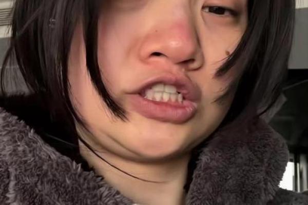 上嘴唇薄长的人:解析命运与性格的奥秘 上嘴唇薄长的人:解析命运与性格的奥秘