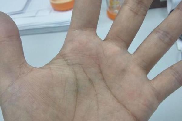 手纹十个圈的人命运解析:解读你的内在潜力与未来之路 手纹十个圈的人命运解析:解读你的内在潜力与未来之路