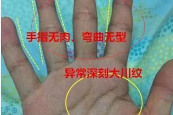 手指尖细的命理解析:解密命运与性格的关系 手指尖细的命理解析:解密命运与性格的关系