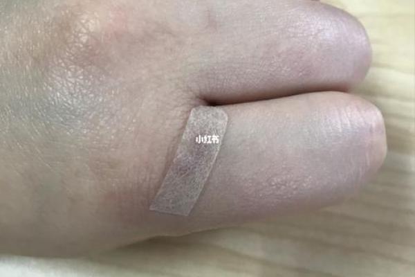 手上有疤,揭示你的命格秘密! 手上有疤,揭示你的命格秘密!