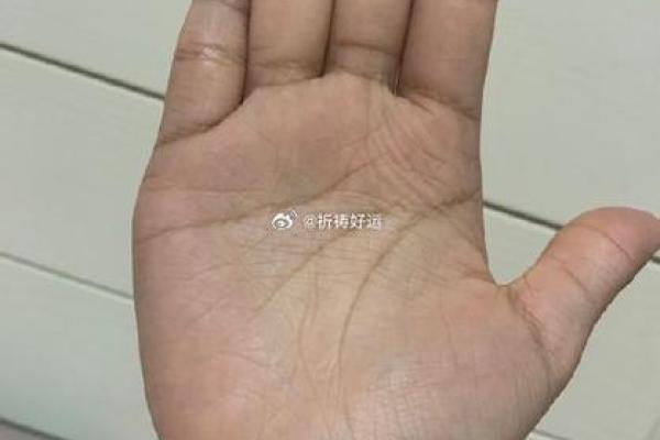 手上三角形手纹的命运揭秘:揭开你的命运密码 手上三角形手纹的命运揭秘:揭开你的命运密码