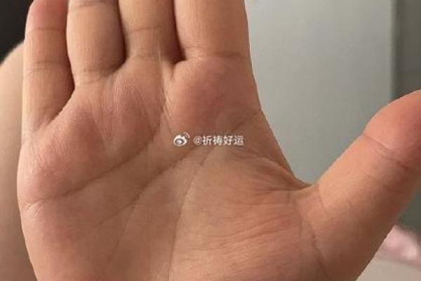 手指头肉多饱满,揭示你与生俱来的命运之谜 手指头肉多饱满,揭示你与生俱来的命运之谜