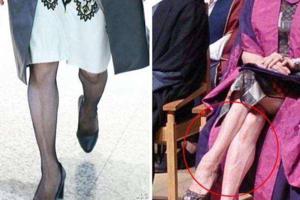 根据上身短下身长的人什么命?解密身形与命运的关系! 根据上身短下身长的人什么命?解密身形与命运的关系!