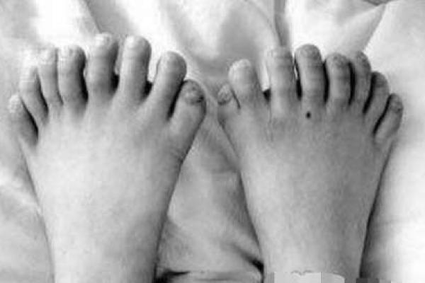 手指与脚趾:生活中被忽视的小英雄与大作用 手指与脚趾:生活中被忽视的小英雄与大作用