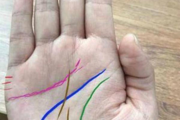 女人心脏在右边的命运与特质探秘 女人心脏在右边的命运与特质探秘