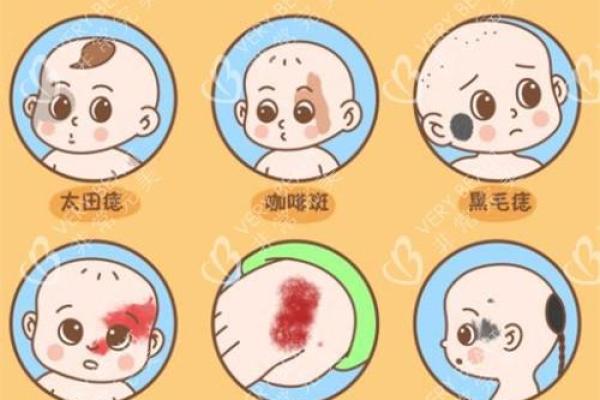 男人腰上有胎记,揭示命运的秘密与人生的启示 男人腰上有胎记,揭示命运的秘密与人生的启示