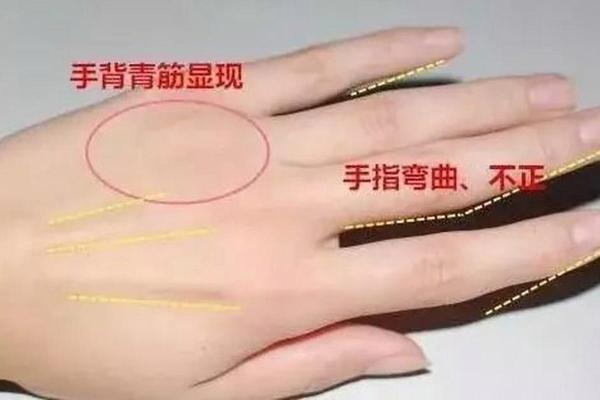 手指肚扁平的人命运解析：你不知道的性格与命运秘密！