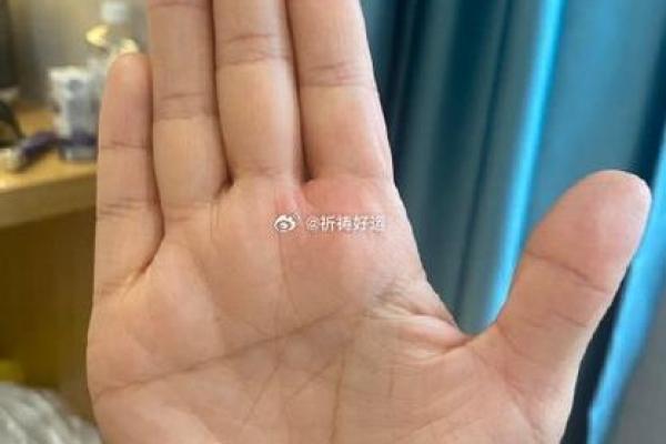 手相解析:揭开手中元宝纹的命运之谜 手相解析:揭开手中元宝纹的命运之谜