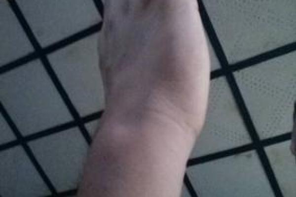 手腕细骨的奥秘：解读手腕两根细骨的命运与意义