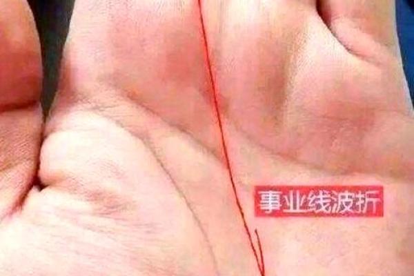 手指纹的秘密：没有螺旋的命运与人生启示