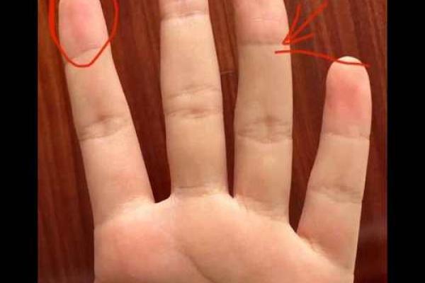 没有指甲的男生:命运与生活的独特解析 没有指甲的男生:命运与生活的独特解析