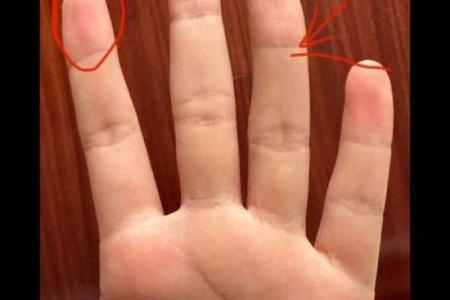 没有指甲的男生：命运与生活的独特解析