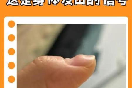 揭示指甲盖弯曲的秘密：了解指甲的健康密码和命运走向