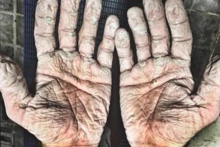 手长奇形怪状，人命各异的奇妙人生