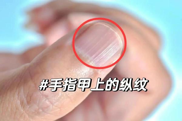 从手上纹数字6看命运：深度解读与人生启示