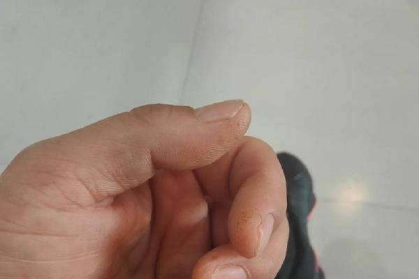 手指关节粗大,命中注定的性格与命运解读 手指关节粗大,命中注定的性格与命运解读