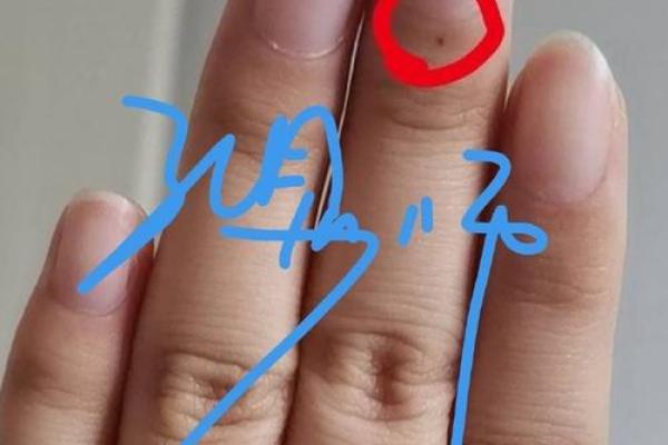 手指无痣，命运的秘密：你知道意味着什么吗？