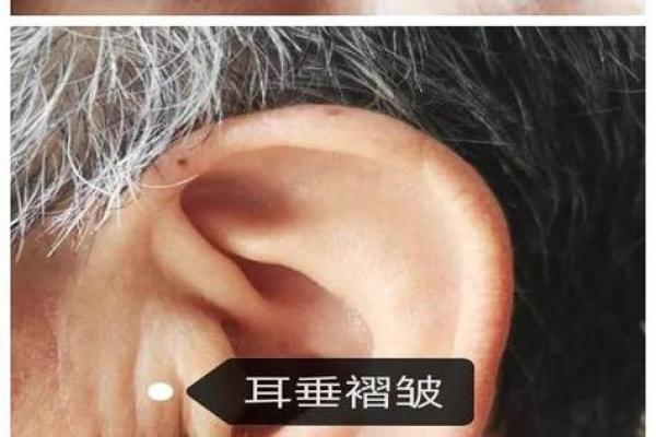 女人口周围长竖纹的命理解析及生活影响