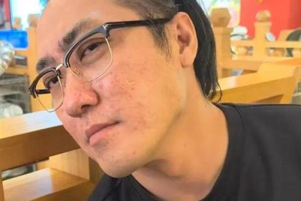 年过半百,头发稀疏,你的命运究竟如何?是福是祸? 年过半百,头发稀疏,你的命运究竟如何?是福是祸?