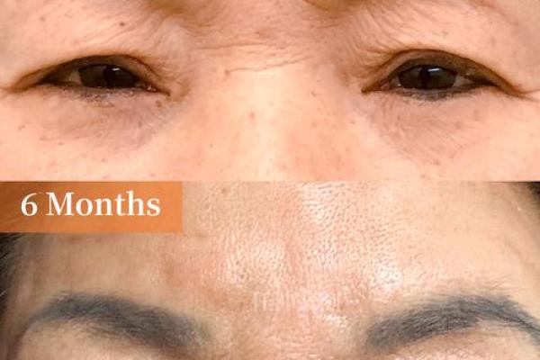 女人眉毛有川字纹是什么命？探秘眉形与命运的联系！