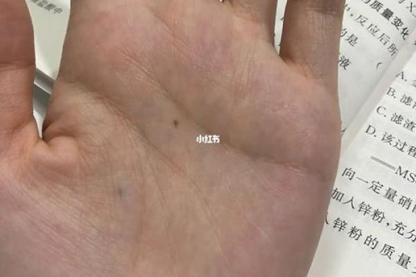 手心有痣的神秘寓意：解读女性命运的隐秘符号