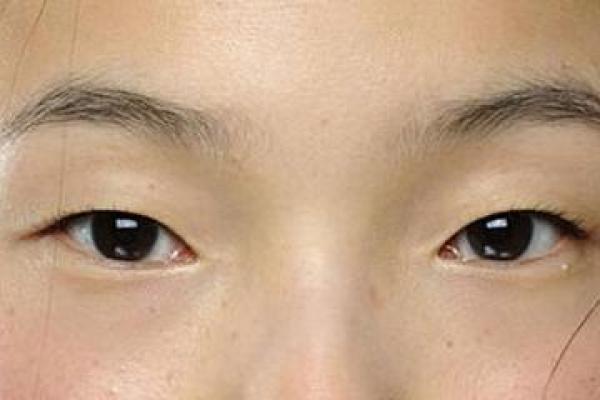 三眼皮男性的魅力与命运解析：揭示隐藏在面相背后的深层意义