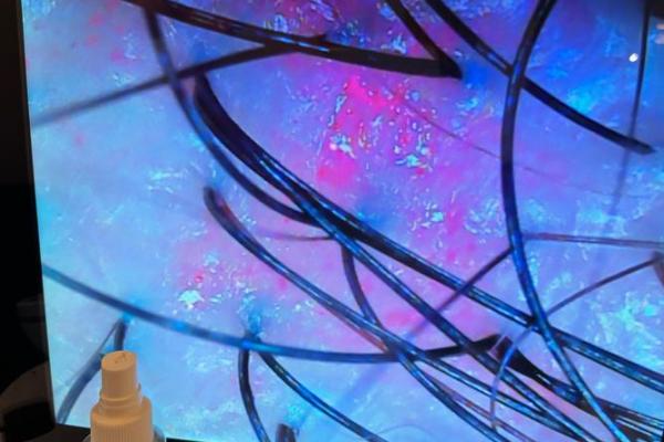 什么颜色的头皮命好，揭秘头皮颜色与运势的微妙关系！