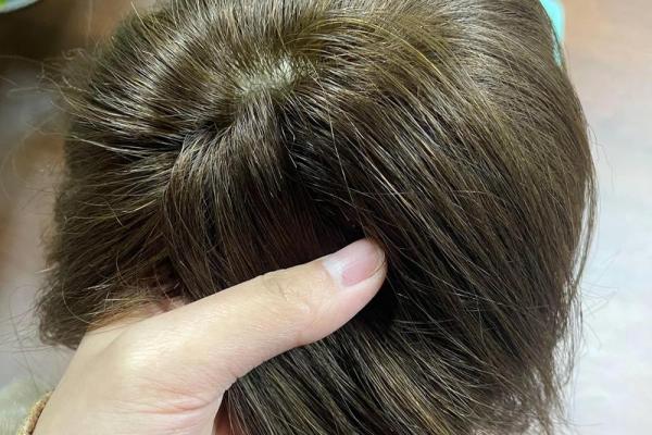 什么颜色的头皮命好，揭秘头皮颜色与运势的微妙关系！