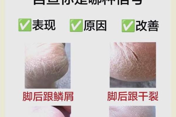 根据什么样的脚后跟命好：揭秘脚型与命运之间的奇妙关系