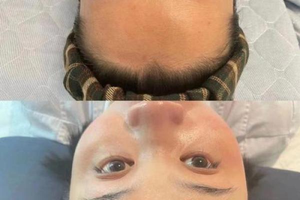 男人抬头纹揭秘:命运与性格的深刻联系 男人抬头纹揭秘:命运与性格的深刻联系