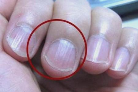 手指甲上的月牙：揭示你命运与健康的秘密
