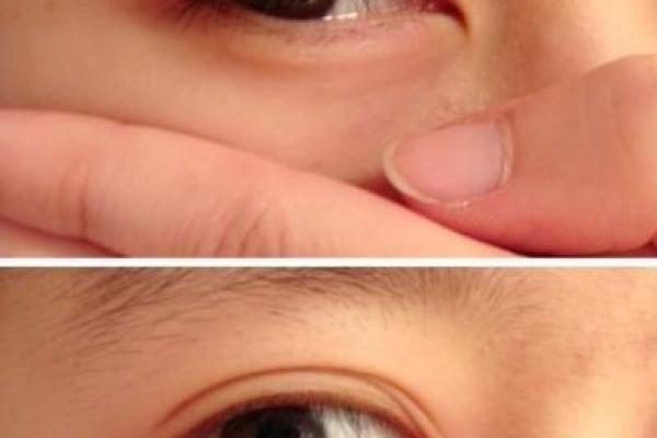 三眼皮男：神秘命运背后的深层意义与影响