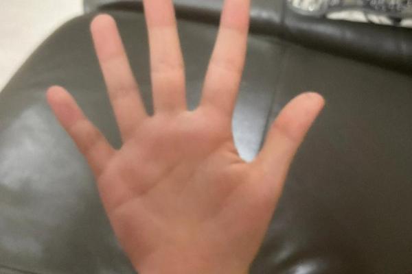 手指肚扁平的人:命运与性格的奇妙关联 手指肚扁平的人:命运与性格的奇妙关联