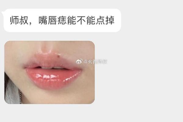 男人嘴巴上有痣:揭示命运的独特标志与生活的深层含义 男人嘴巴上有痣:揭示命运的独特标志与生活的深层含义