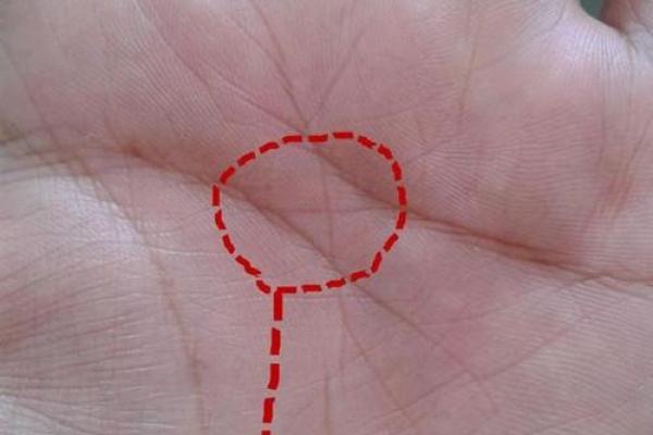 手相与命运:血管青紫象征的神秘力量解析 手相与命运:血管青紫象征的神秘力量解析