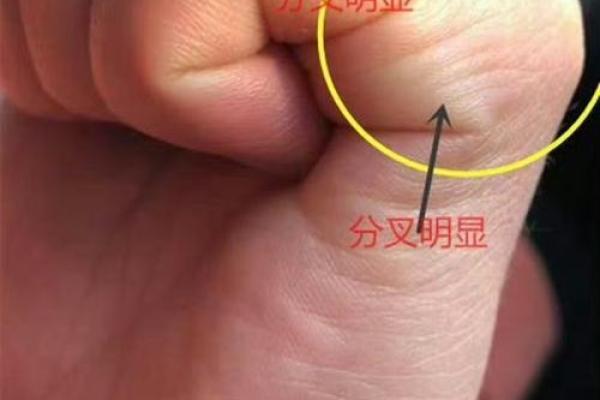 解密元宝纹:手相中的财富象征与人生指导 解密元宝纹:手相中的财富象征与人生指导