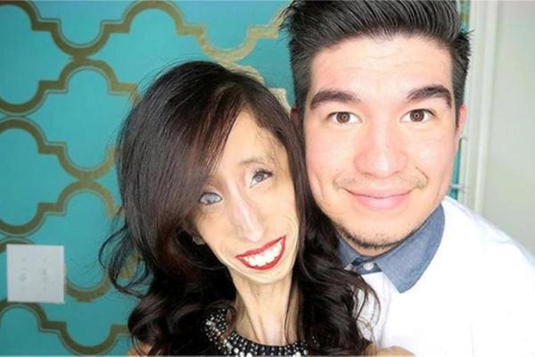 人丑手美的女人：命运与美丽的独特交织