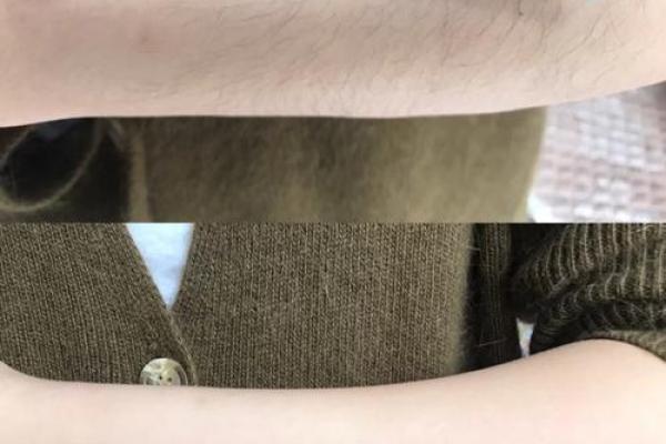 女子身上不长体毛的秘密与命运解析