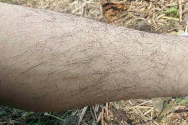 女子身上不长体毛的秘密与命运解析