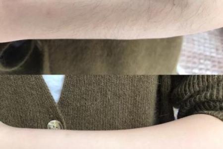 女子身上不长体毛的秘密与命运解析