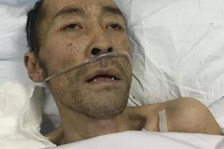 当病魔来袭：你绝对想不到的致命疾病